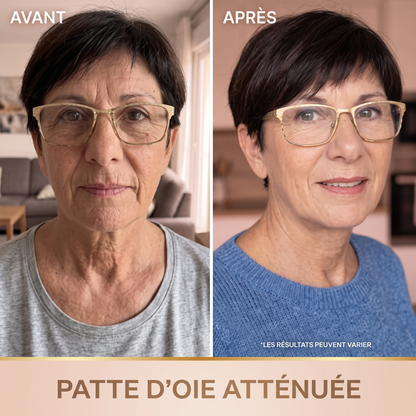 Avant apres zoom