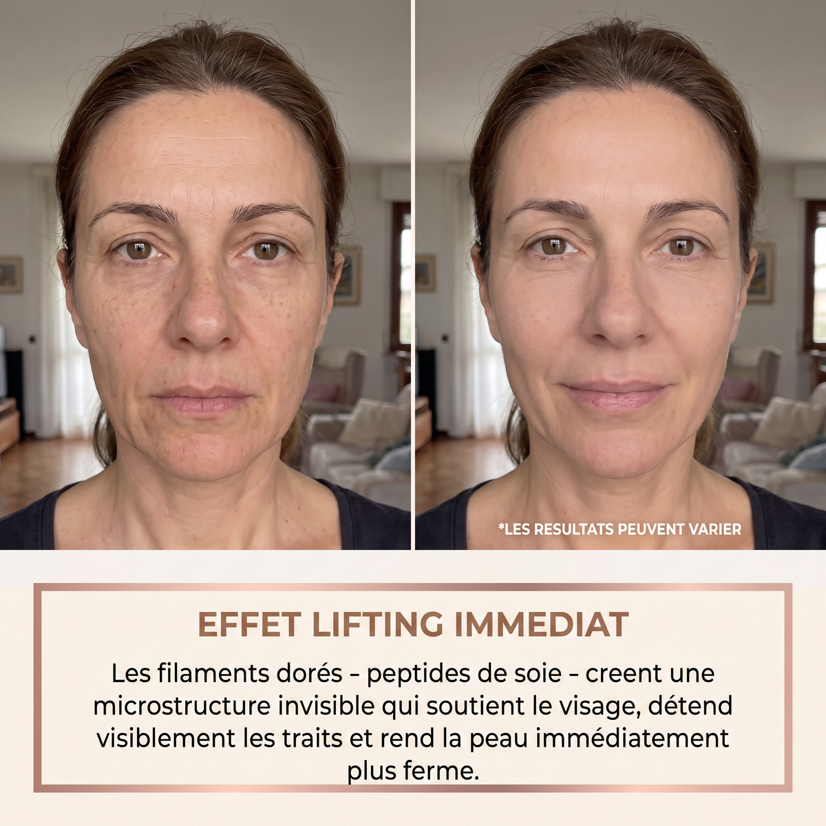 Avant apres effet lifting immediat