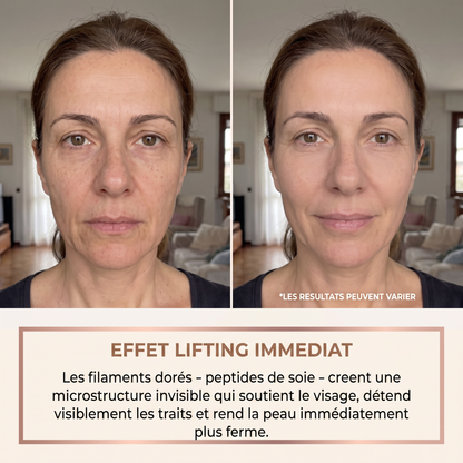 Avant apres effet lifting immediat