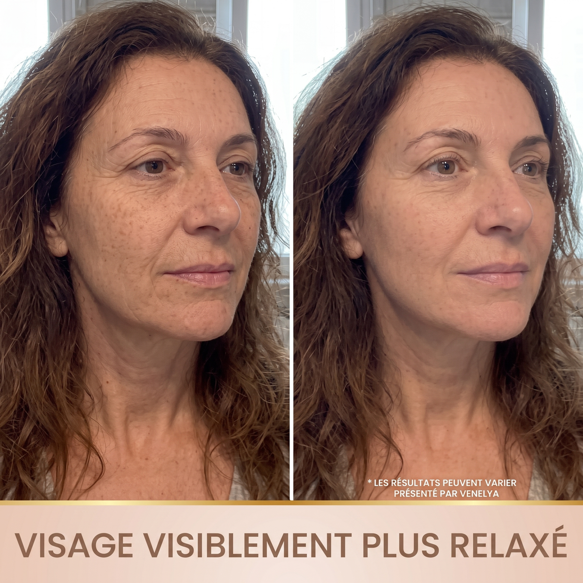 Avant apres visage