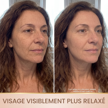 Avant apres visage