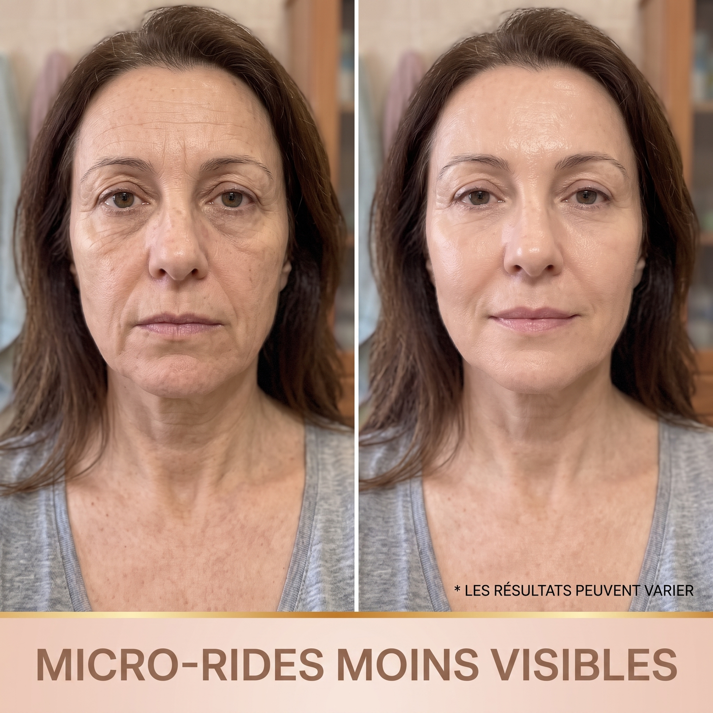 Avant apres micro-rides