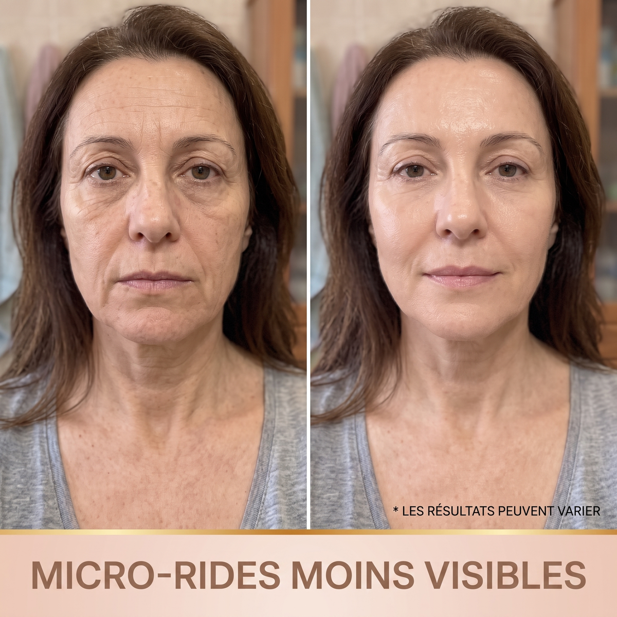 Avant apres micro-rides