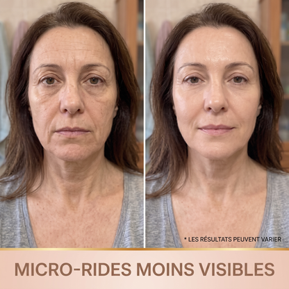 Avant apres micro-rides